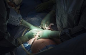 Caesarean section (C-section) delivery rates in Kenya have continued to rise steadily over the past five years. Here are the reasons…